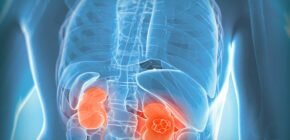 ΠΠΎΡΠΊΠΈ Π½Π° ΡΠ½ΠΈΠΌΠΊΠ΅